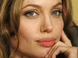 После удаления молочных желез А.Джоли предстоит еще одна операция